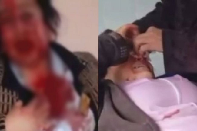 Видео: В Узбекистане врачу, которая ударила свою коллегу чайником по голове, дали год заключения