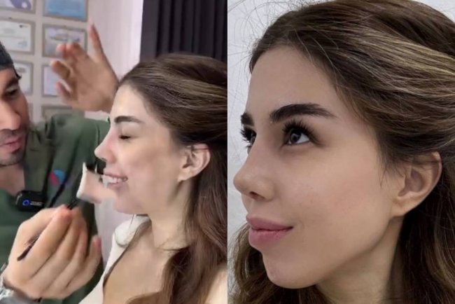Узбекская блогерша Диера Азимова показала свой «новый» нос — видео