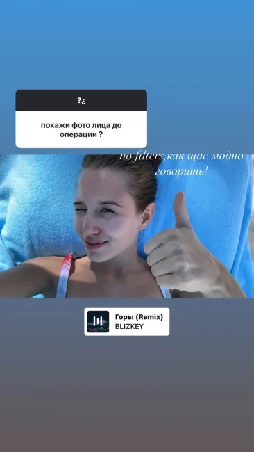Юная возлюбленная Григория Лепса поделилась снимком до пластики