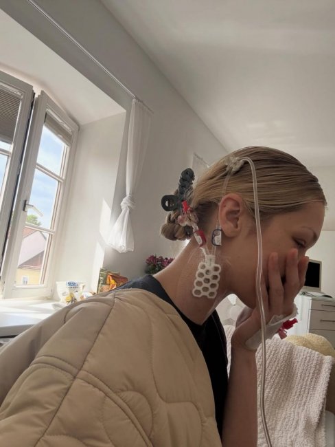 Белла Хадид откровенно рассказала о борьбе с болезнью Лайма