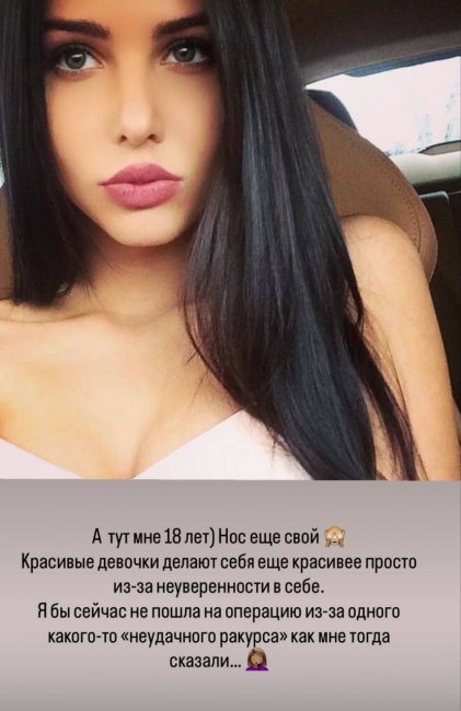 Анастасия Решетова показала себя до пластики