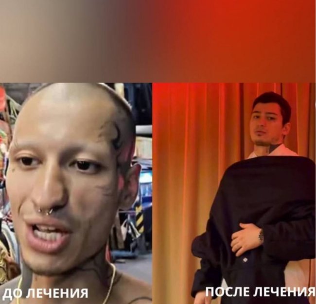 Matrang вернулся после лечения