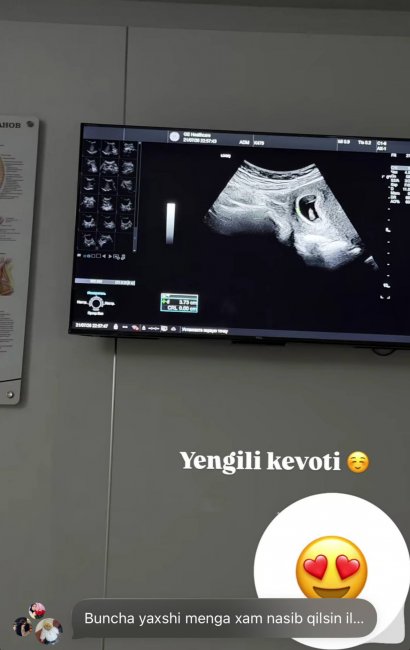 Узбекская блогерша Севинчка намекнула на вторую беременность